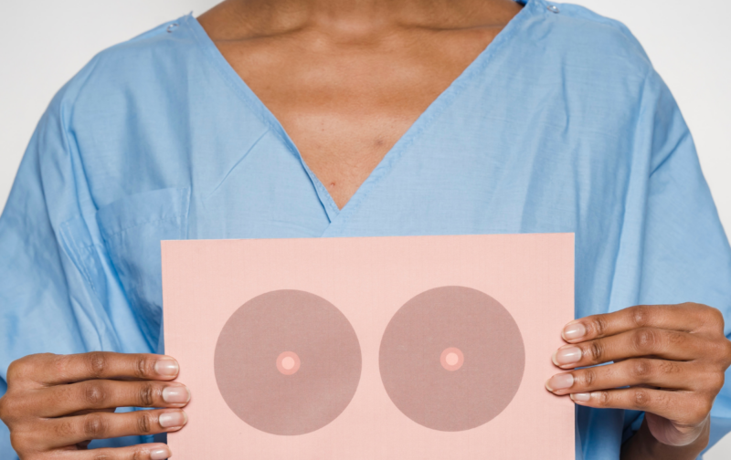 Breast density.